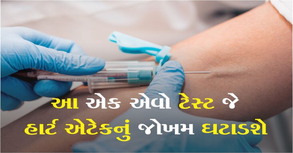 18 વર્ષની ઉંમરે કરાવો આ ટેસ્ટ, જેનાથી હાર્ટ એટેકનો ખતરો 50% ઘટશે, Aiims-ગંગારામના ડોક્ટરોએ કેમ આવી આપી સલાહ?