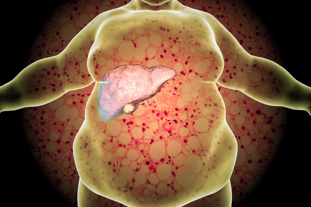 Fatty Liver: તમારા લીવરને સ્વસ્થ રાખવા માટે, દરેક ખૂણામાંથી ચરબી દૂર કરવા માટે આ 3 ફૂડ કોમ્બોઝ ખાઓ.
